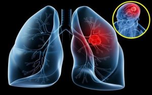 5 thói quen hại phổi